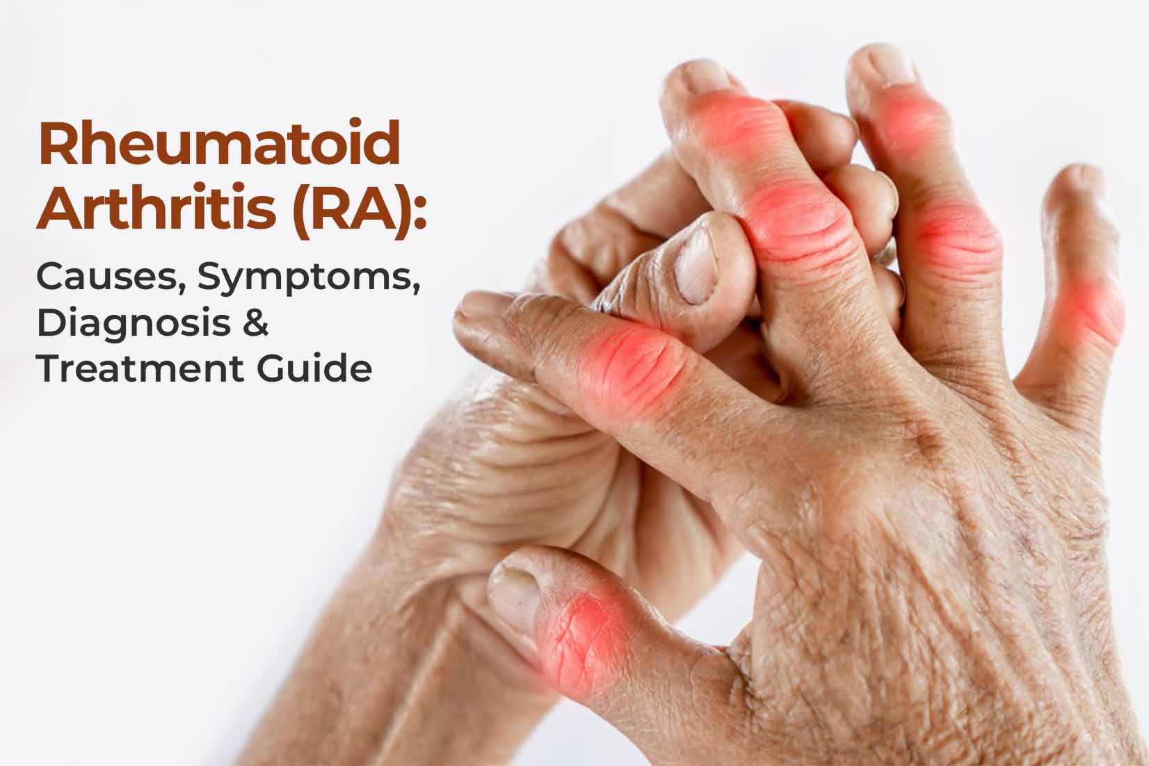 Rheumatoid Arthritis (RA): Causes, Symptoms, Diagnosis & Treatment Guide