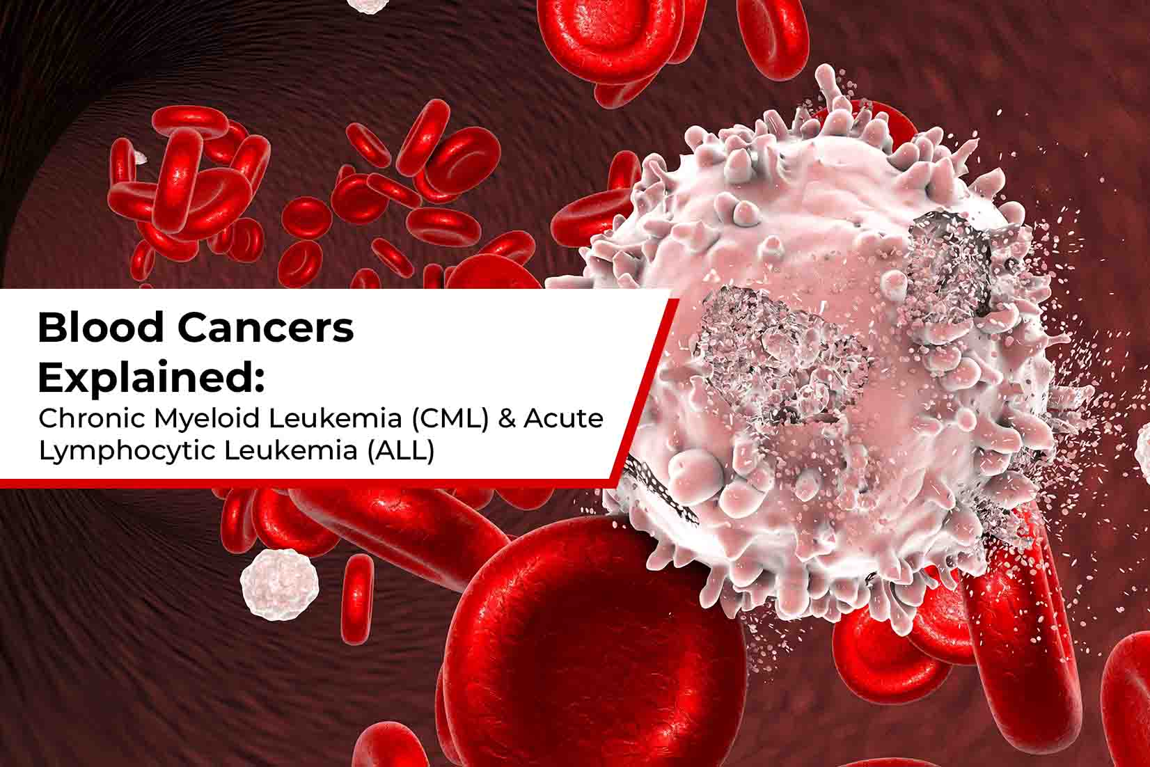 Blood Cancers Explained: Chronic Myeloid Leukemia (CML) & Acute Lymphocytic Leukemia (ALL)