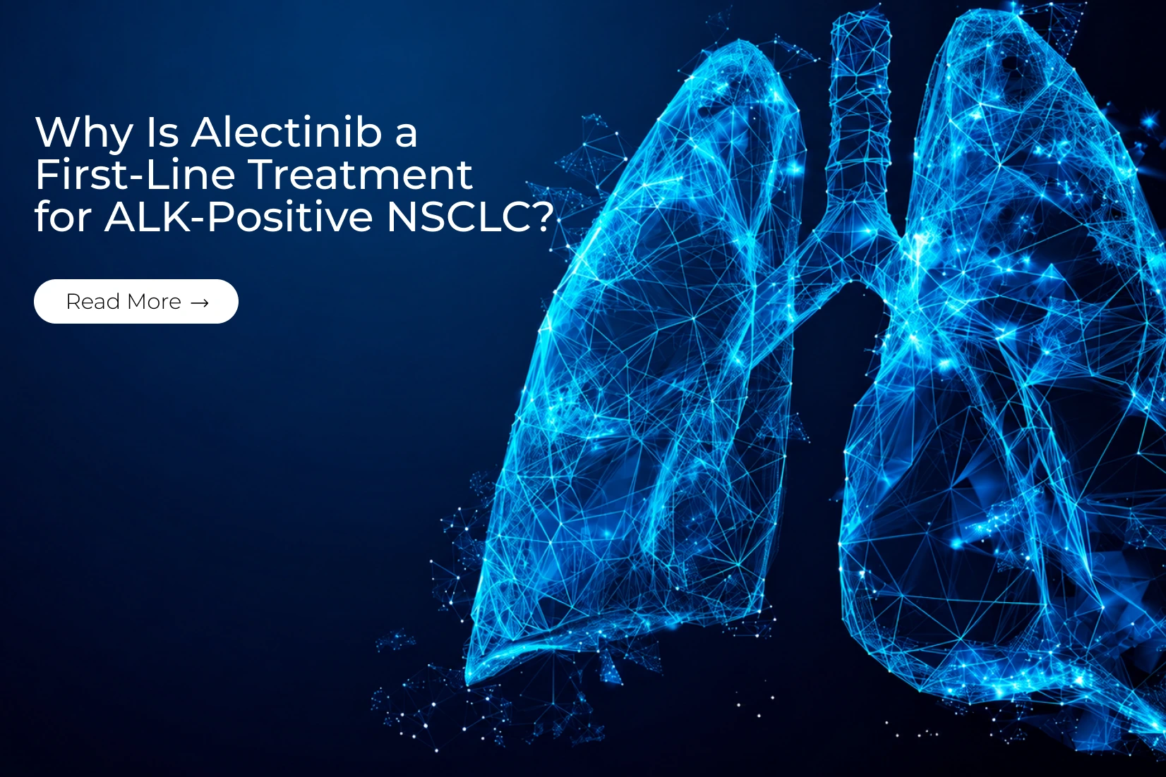 Why Is Alectinib a First-Line Treatment for ALK-Positive NSCLC?