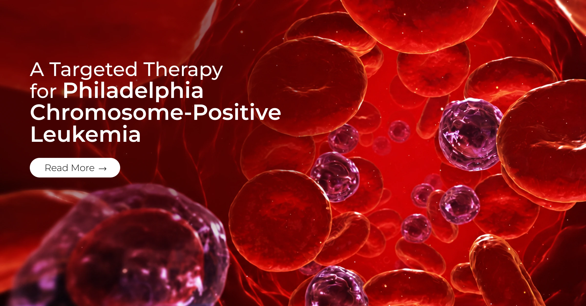 A Targeted Therapy for Philadelphia Chromosome-Positive Leukemia