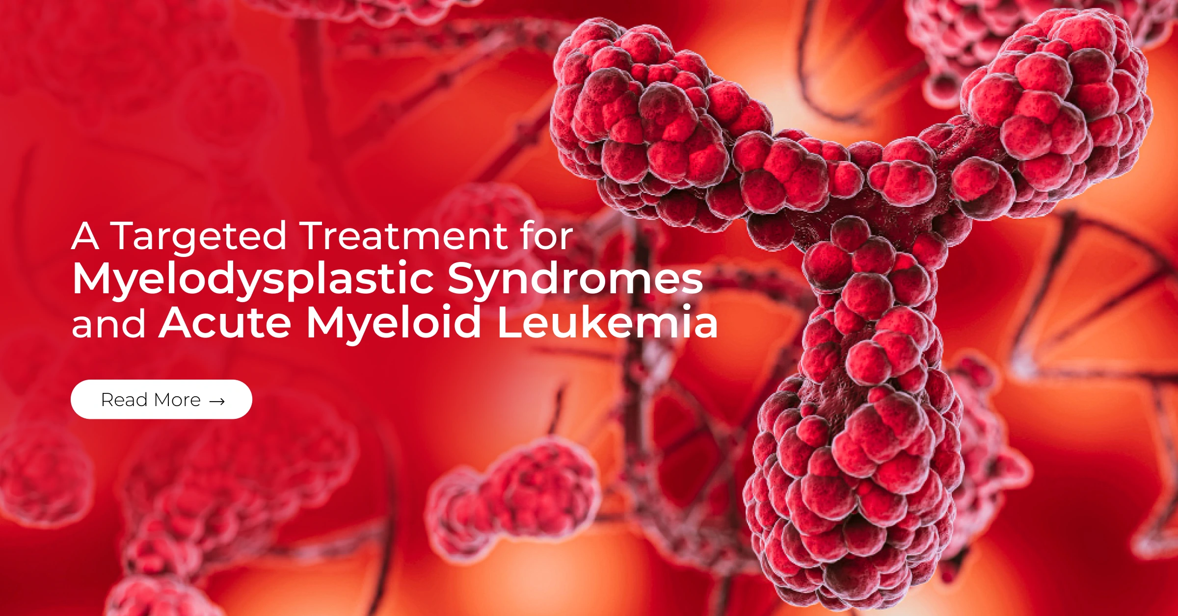 A Targeted Treatment for Myelodysplastic Syndromes and Acute Myeloid Leukemia