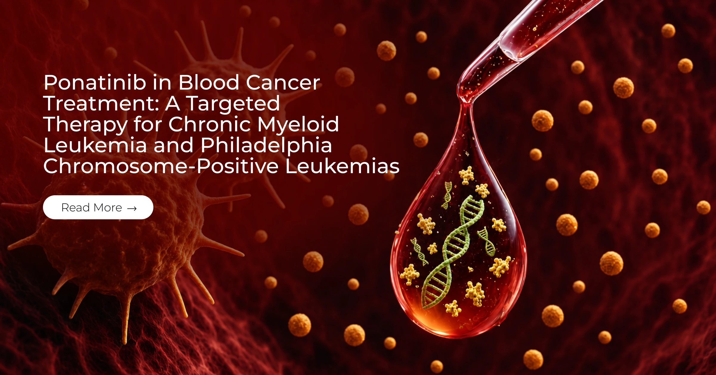 Ponatinib in Blood Cancer Treatment: A Targeted Therapy for Chronic Myeloid Leukemia and Philadelphia Chromosome-Positive Leukemias